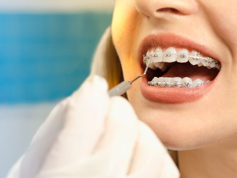 دوره آموزش ارتودنسی دندان