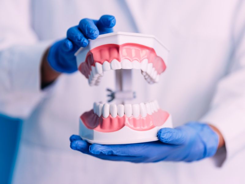 آموزش قالب گیری دندان